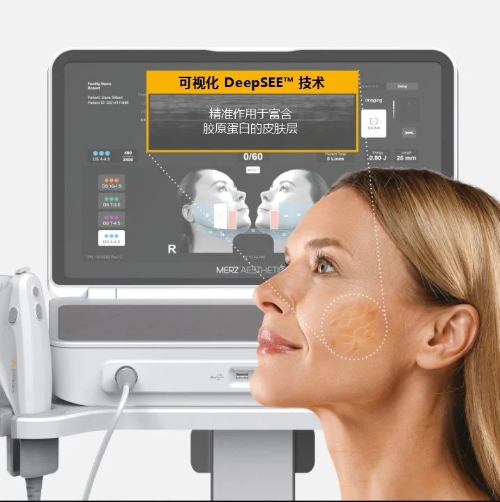 超声刀Prime DeepSEE 实时影像