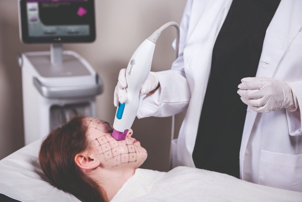 Ultherapy PRIME