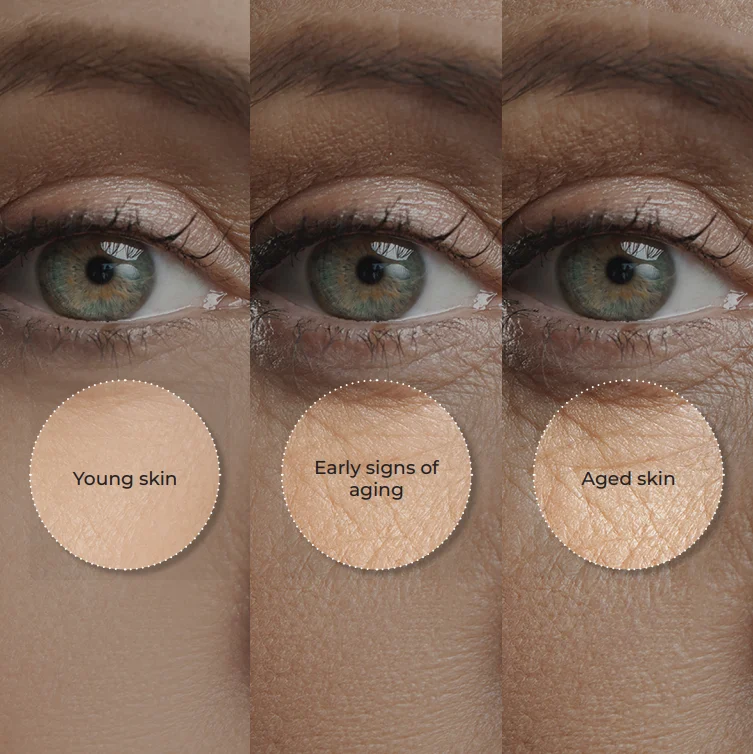 SkinTightening and AntiAging
